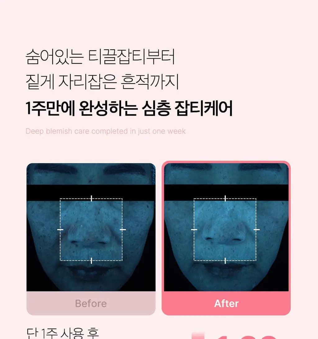 [쿨링광채]메디큐브 PDRN 핑크 콜라겐 토닝 겔 토너패드 70매 기획(본품70매+겔패드10매) 상세페이지 46
